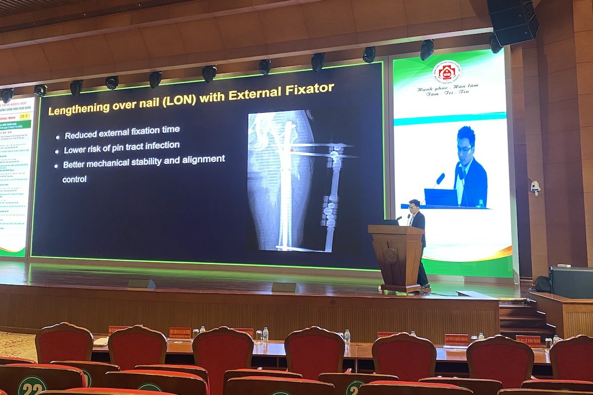 BC Kéo dài chân - bệnh viện 108